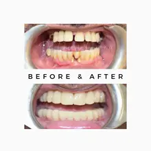 Before After 3