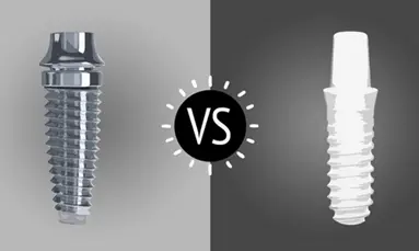 What are advantage of metal free implants?