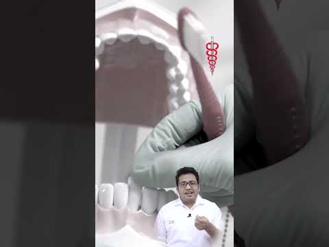 YouTube Short 1 - Dr Chirag Chamria